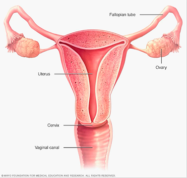 Ovarian Cyst illustration